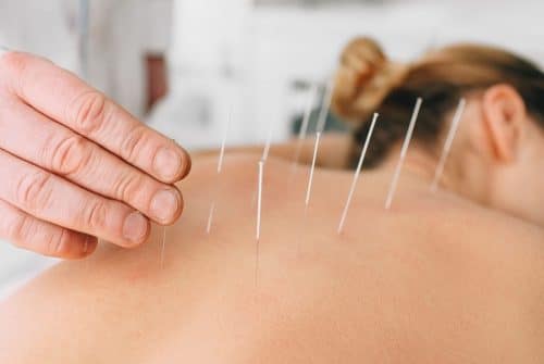 Quelles sont les prestations d’un acupuncteur professionnel ?