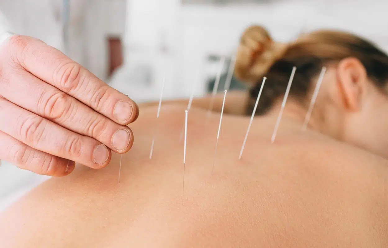 Quelles sont les prestations d’un acupuncteur professionnel ?